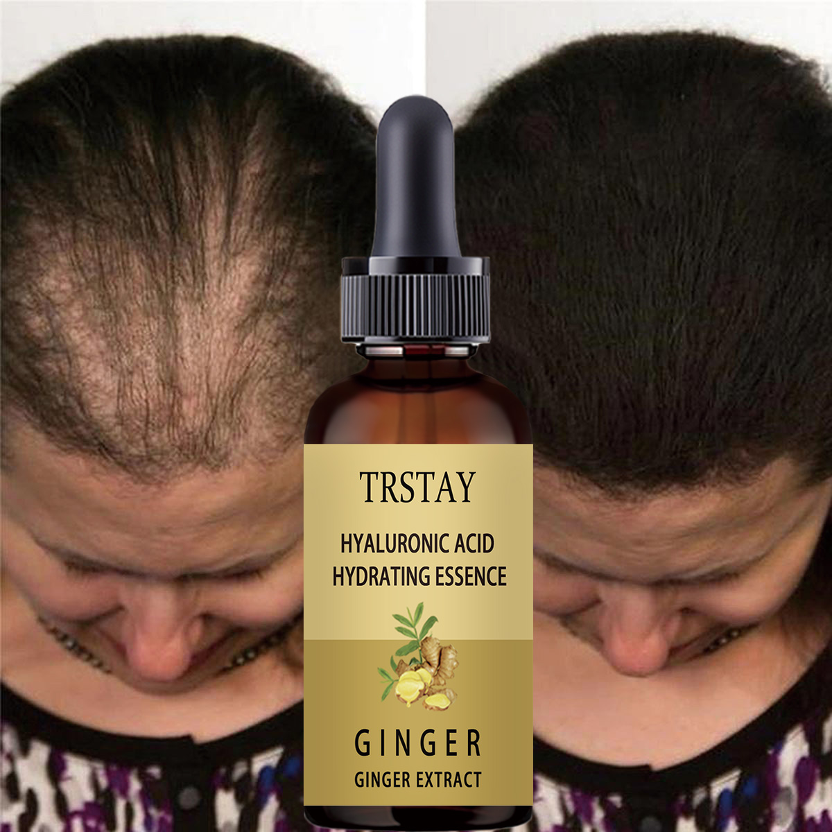 Serum na porost włosów zapobie – Caffeine Hair Serum recenzja i cena