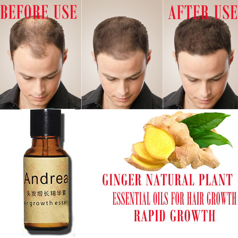 2/5/10Pcs Andrea Hair Growth S – Hair Care Herbal recenzja i cena