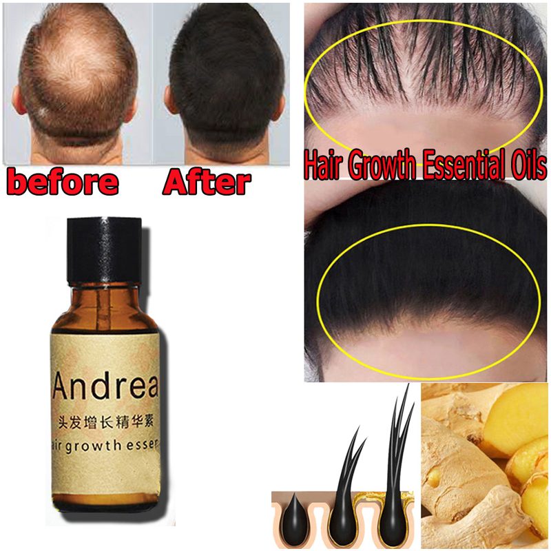 2/5/10Pcs Andrea Hair Growth S – Hair Care Herbal recenzja i cena