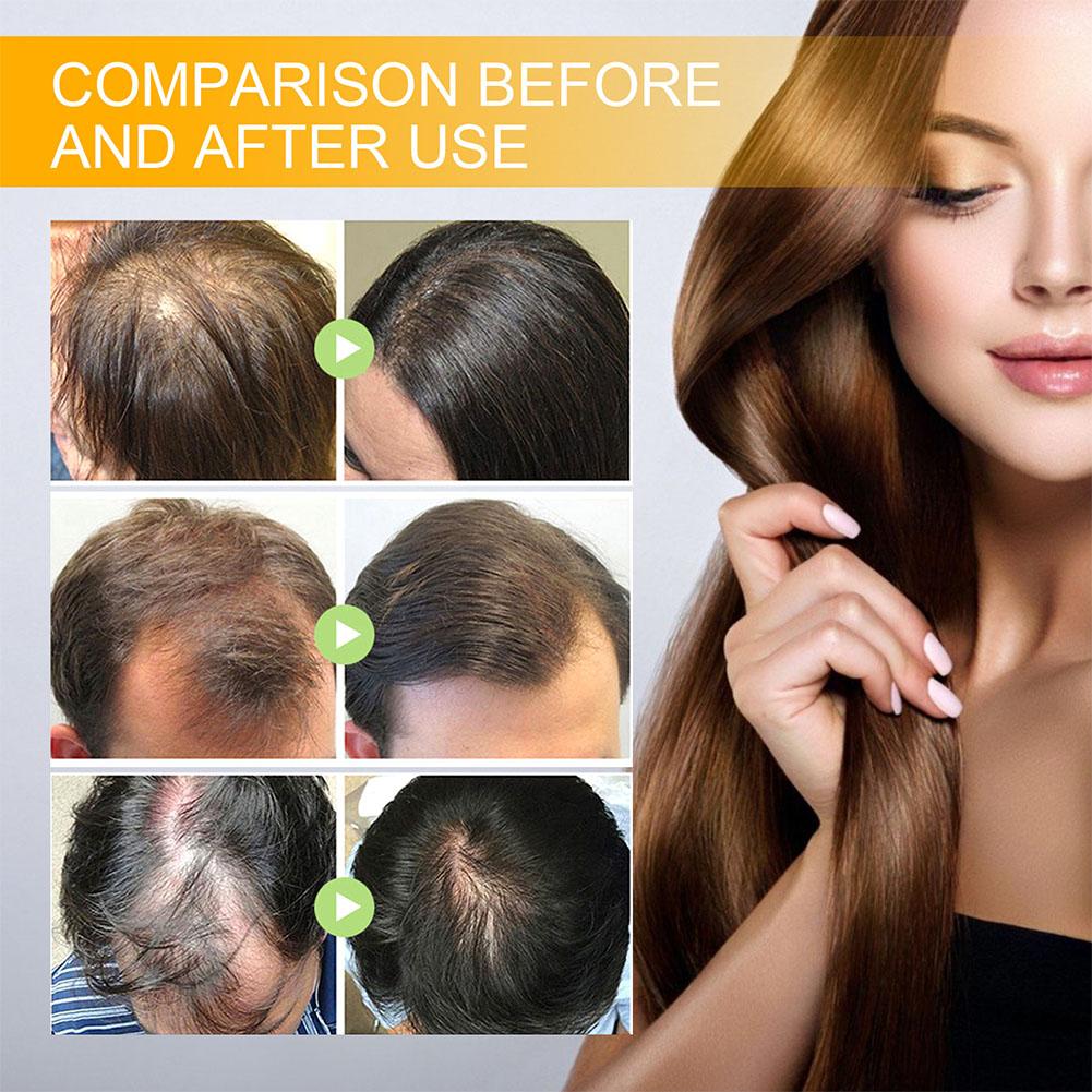 5/3/1 sztuk biotyna produkty n – Hair Care Herbal recenzja i cena